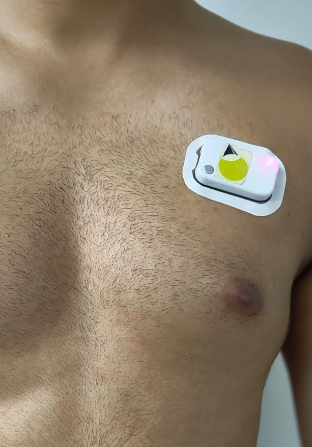 Canary Sentis Wearable Biosensor
